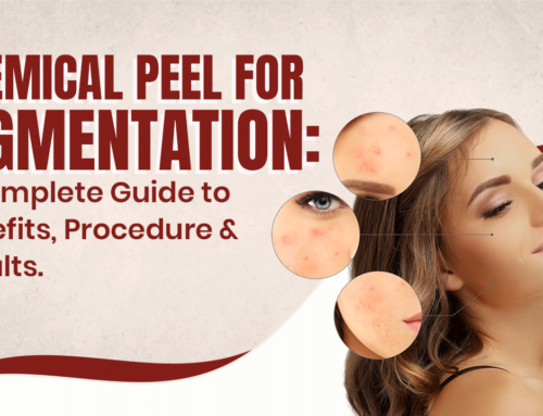 Chemical Peel For Pigmentation: A Complete Guide to Benefits, Procedure & Results.